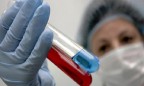 В Одессе зафиксирована смерть от свиного гриппа