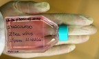 В ЮАР зафиксирован первый случай заражения вирусом Зика