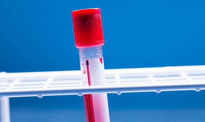 В России зафиксирован второй случай лихорадки Зика