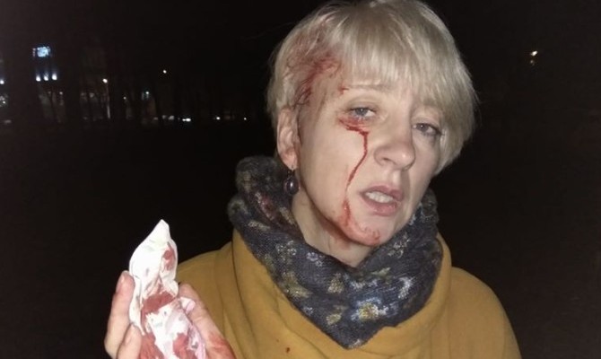 В Полтаве избили судью Ларису Гольник