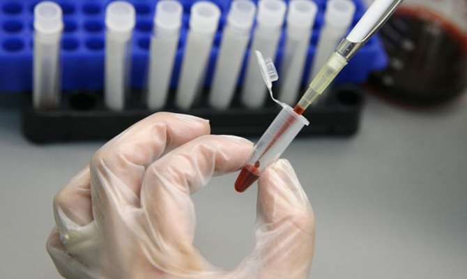 В Запорожье десятки людей заболели гепатитом А