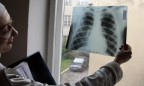 Ежегодно около 30 тыс. украинцев заражаются туберкулезом