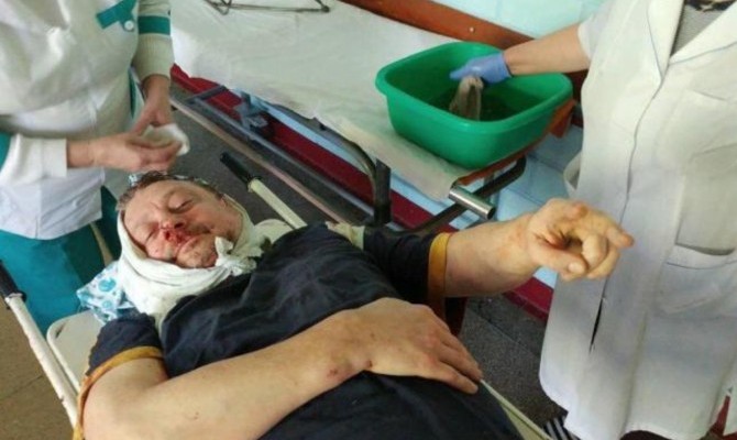 На Полтавщине избили однопартийца Саакашвили