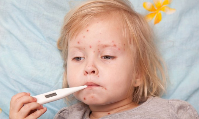В Украине растет заболеваемость корью, - МОЗ