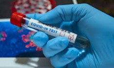 У главы Тернопольской ОГА обнаружен коронавирус