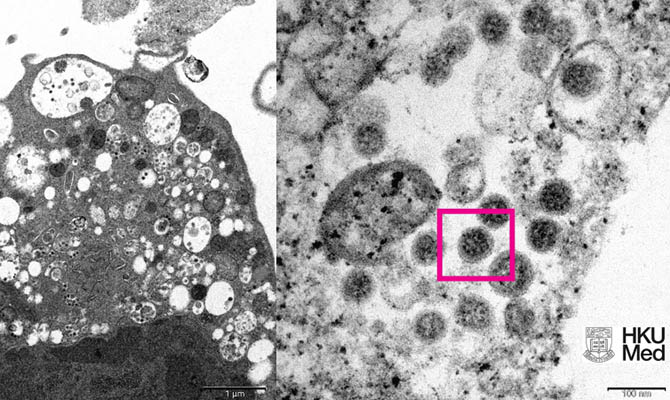 Ученые Гонконга опубликовали изображение омикрон-штамма коронавируса